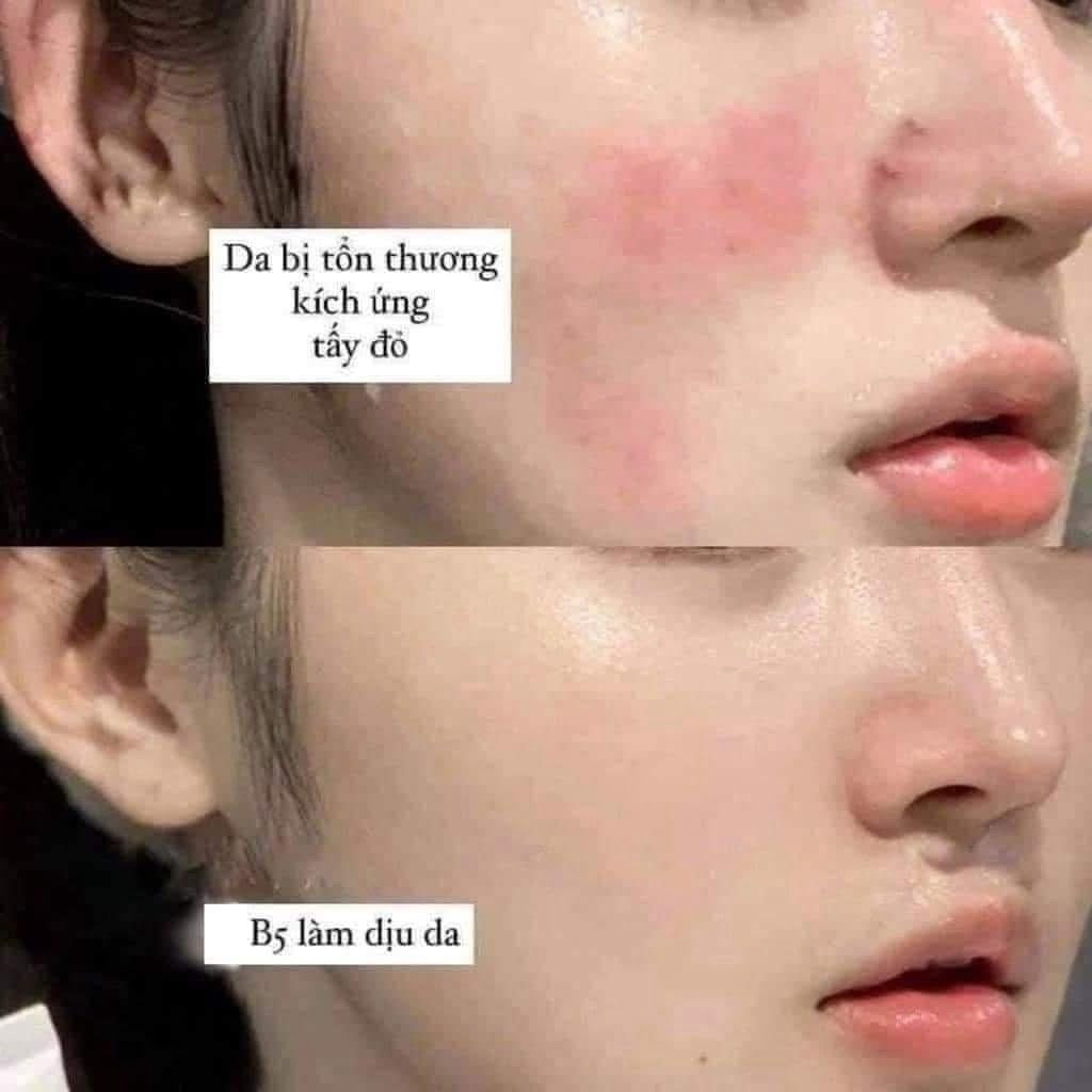 Tinh chất phục hồi da MEDIK8 Hydr8 B5 Intense 30ml