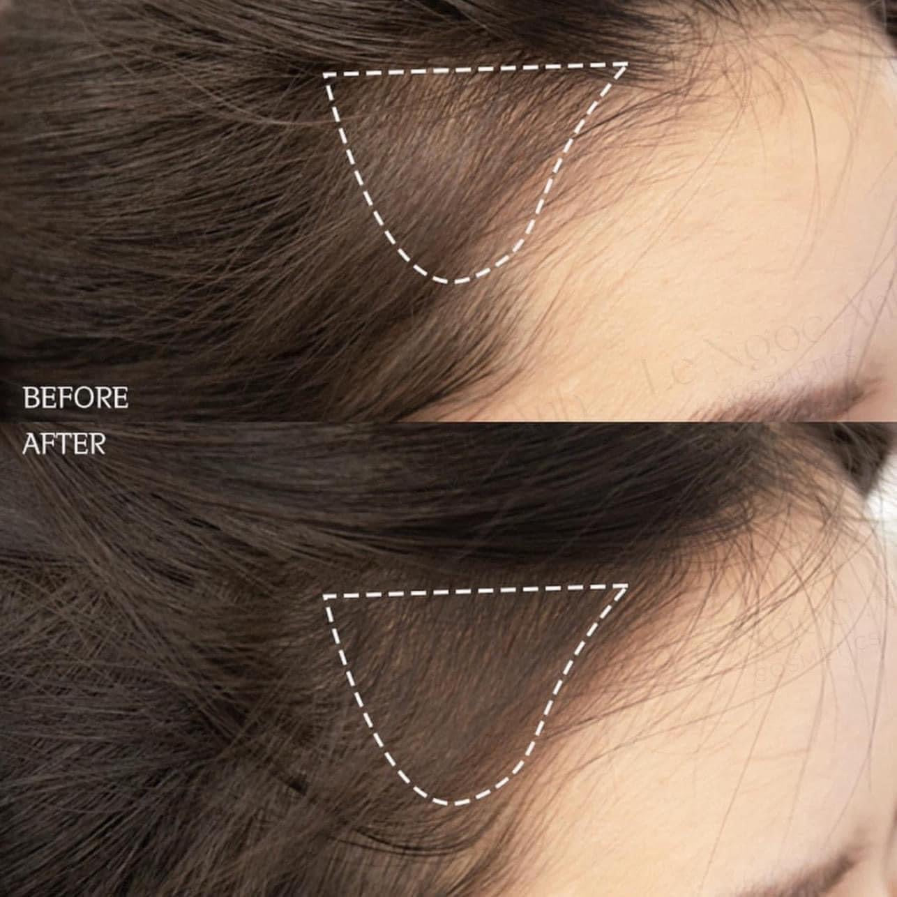 Phấn che khuyết điểm tóc THEFACESHOP Quick Hair Puff