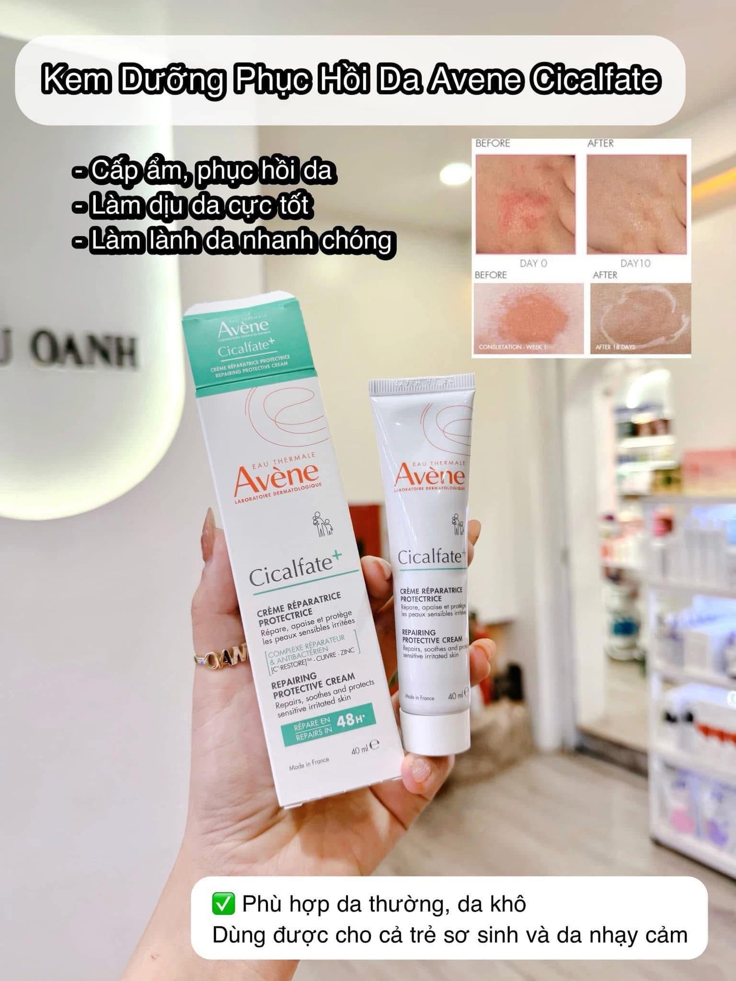 Kem dưỡng phục hồi AVÈNE Cicalfate+