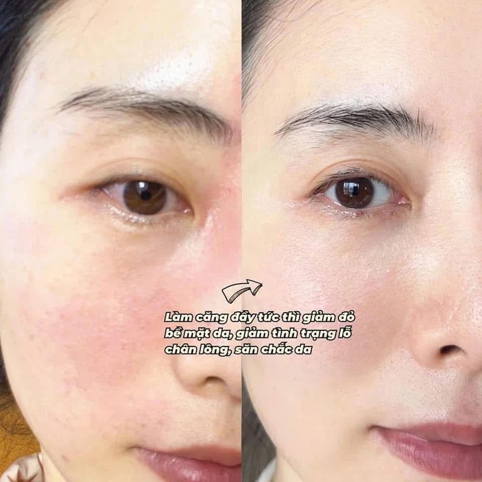 Set gift dưỡng đêm và nước thần vàng CLE DE PEAU Ultimate Daily Cream Care
