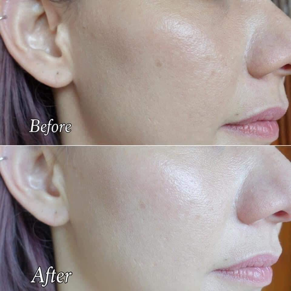 Tinh chất sáng da mờ nám cao cấp MURAD Rapid Age Spot Correcting Serum 30ml