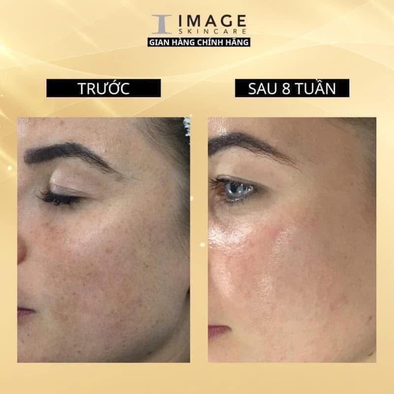 Tinh chất sáng da, ức chế đốm nâu IMAGE Iluma