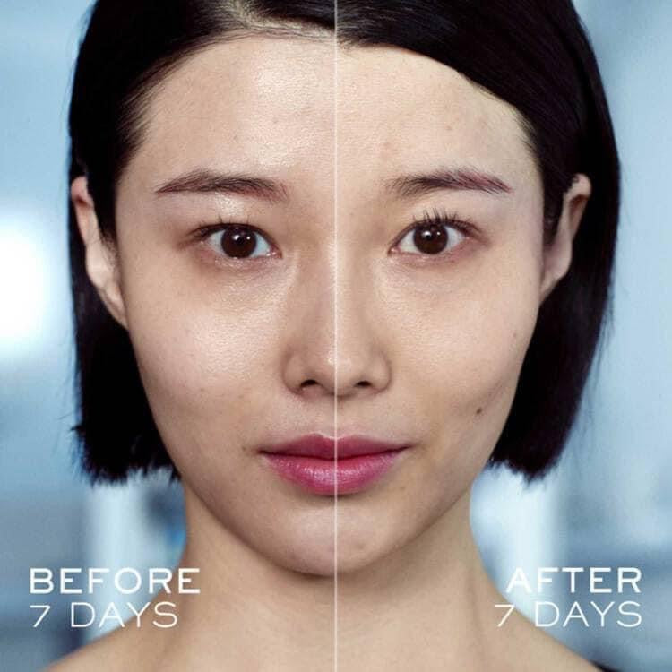 Tinh chất dưỡng LANCÔME Genifique Ultimate 30ml