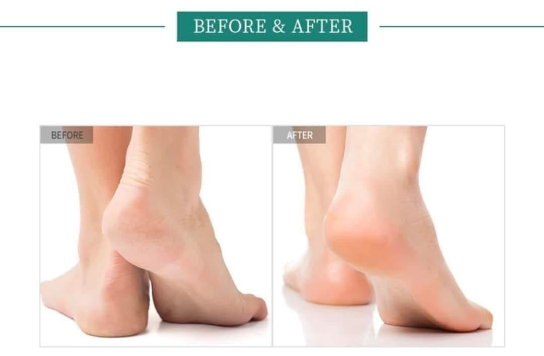 Thanh lăn dưỡng da chân CICA Foot Balm 20g