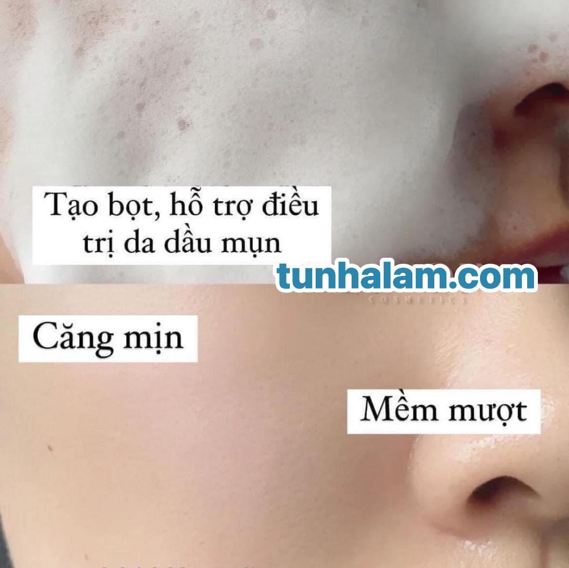 Sữa Rửa Mặt Tạo Bọt LA ROCHE-POSAY Effaclar cho da dầu nhạy cảm 300ml