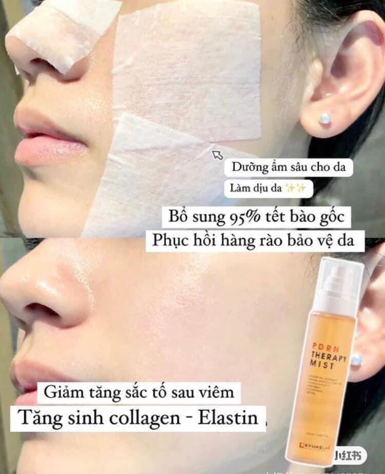 Xịt khoáng KYUNG LAB PRND Therapy Mist