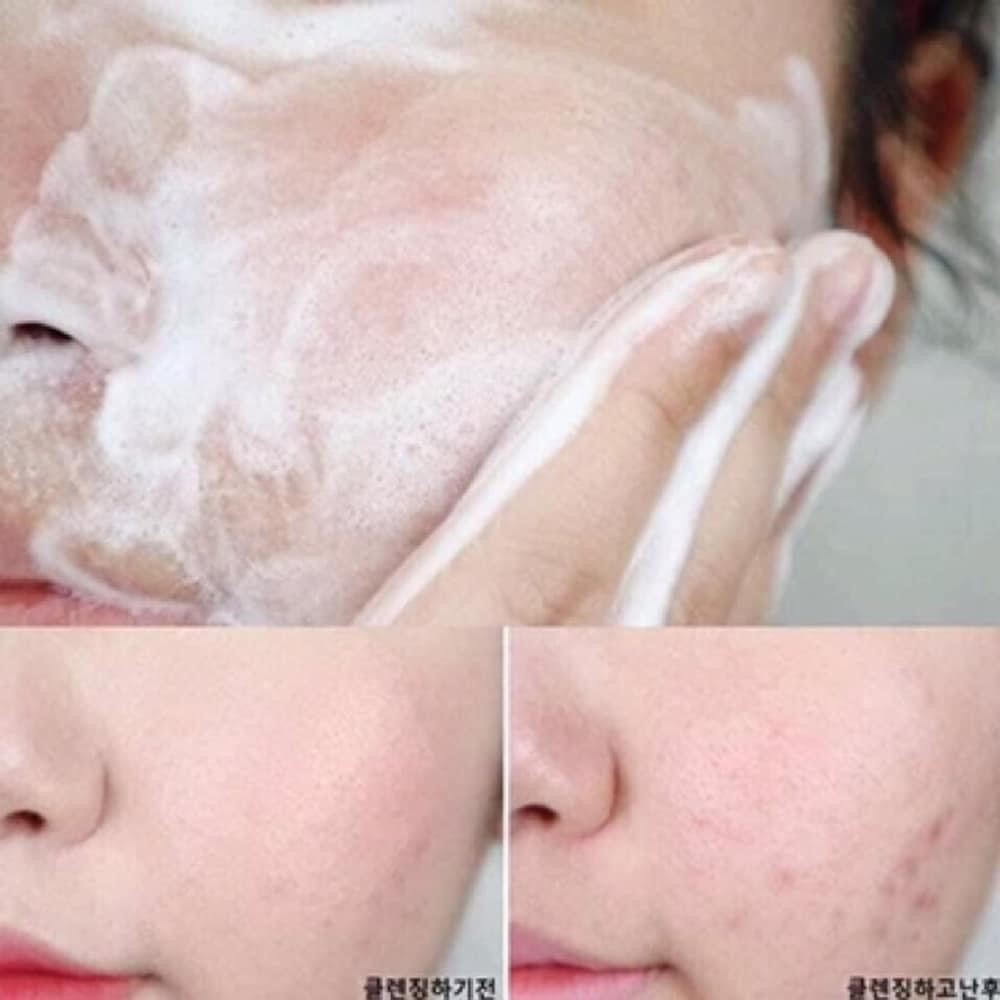 Sữa Rửa Mặt SKIN1004 Madagascar Centella Ampoule Foam 125ml