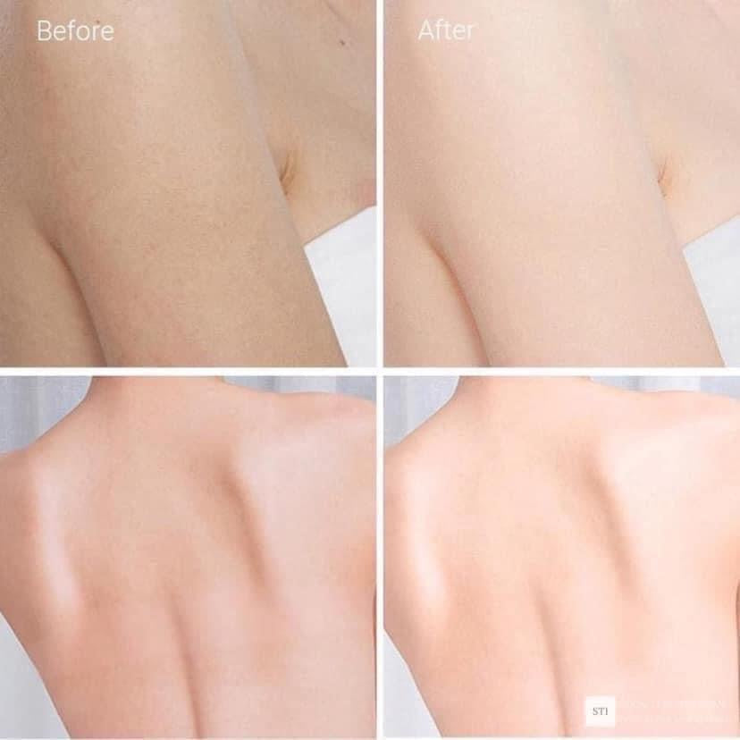 Dưỡng thể kích trắng VASELINE Thái Lan 330ml