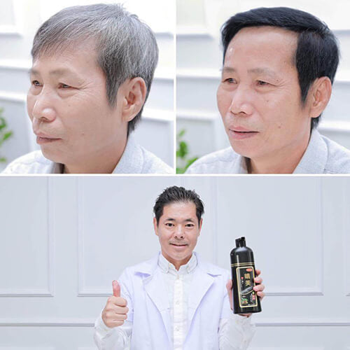 Dầu Gội Phủ Bạc KOMI Nhật Bản 500ml