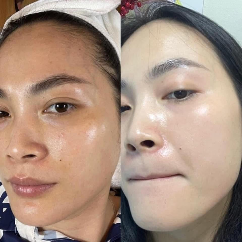 Kem dưỡng sáng da ZO SKIN HEALTH Brightalive Skin Brightener