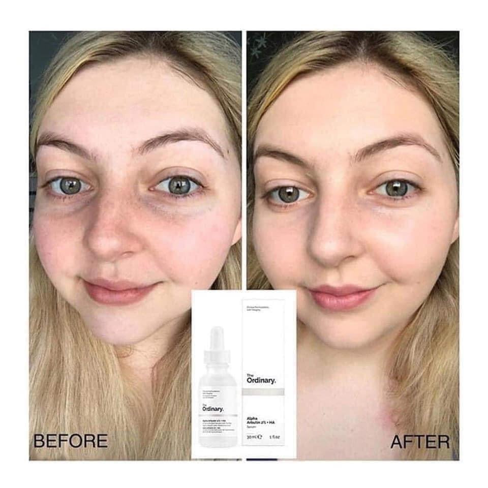 Tinh chất dưỡng trắng THE ORDINARY Alpha Arbutin 2% + HA