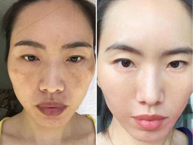 Kem dưỡng thải độc da ban đêm MURAD City Skin Overnight Moisturizer 50ml