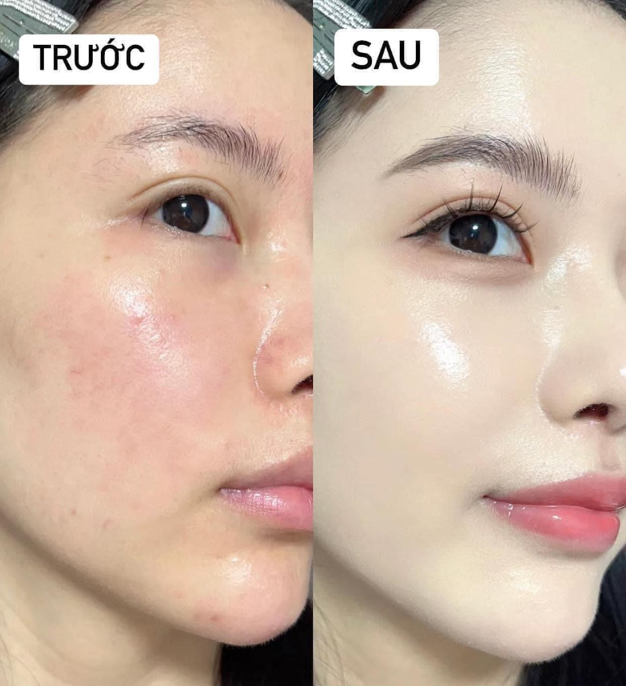 Phấn tươi AGE 20'S SPF50+/PA+++ Hàn Quốc