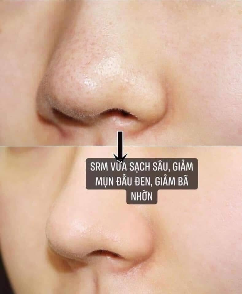 [Hàng order] Sữa rửa mặt MEDIK8 Surface Radiance Cleanser