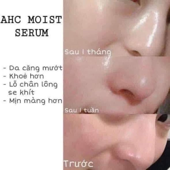 Tinh chất dưỡng da AHC Capture Solution Signature Moist Ampoule 50ml