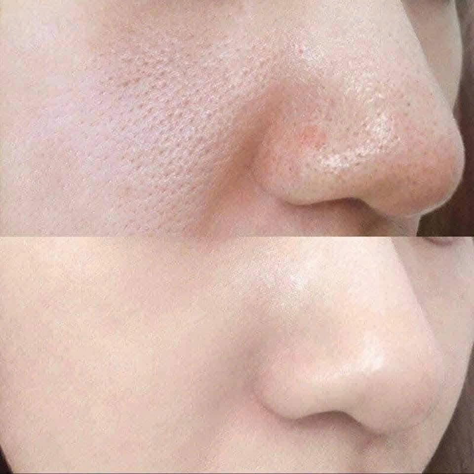 Set Phấn chống nắng WHOO Cushion Sun Balm tặng dầu tẩy trang