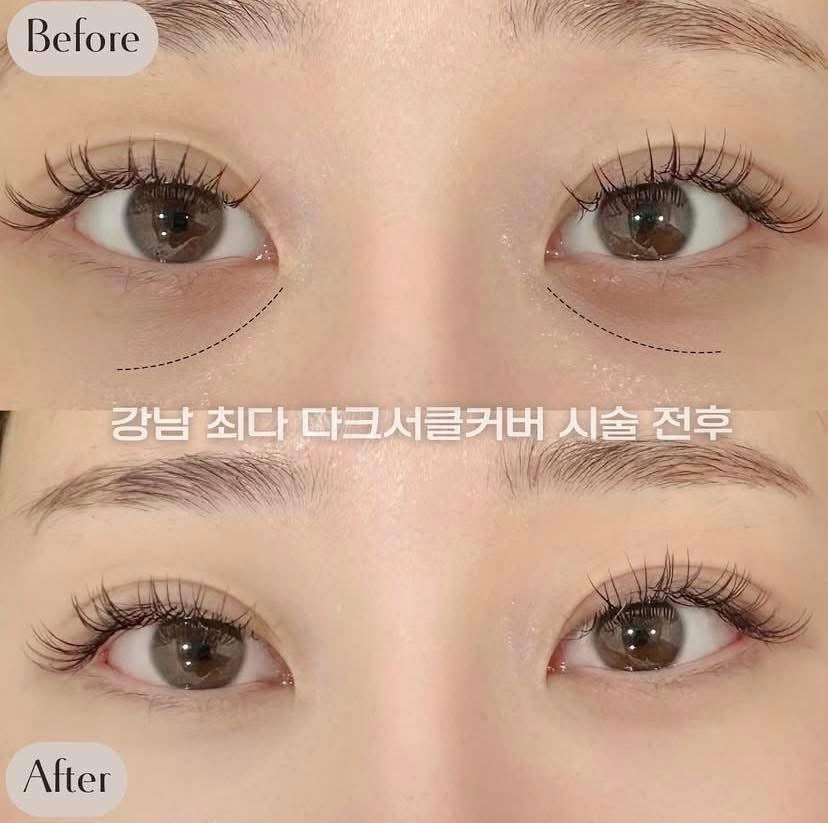 Kem mắt AHC 3X Collagen 40ml