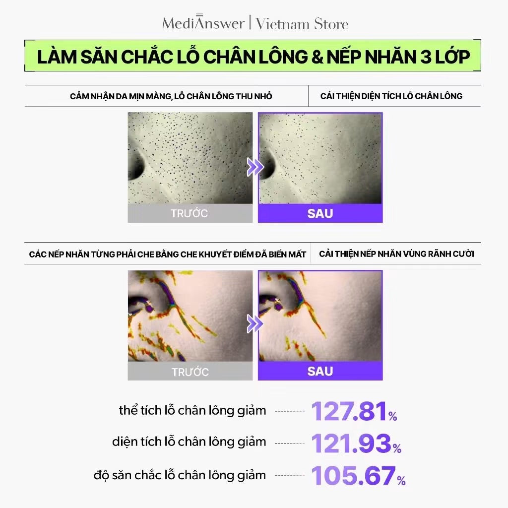 Mặt nạ nâng cơ tức thì và trẻ hoá da chuyên sâu MEDIANSWER Retinoid Liftxyl (hộp 4 miếng)