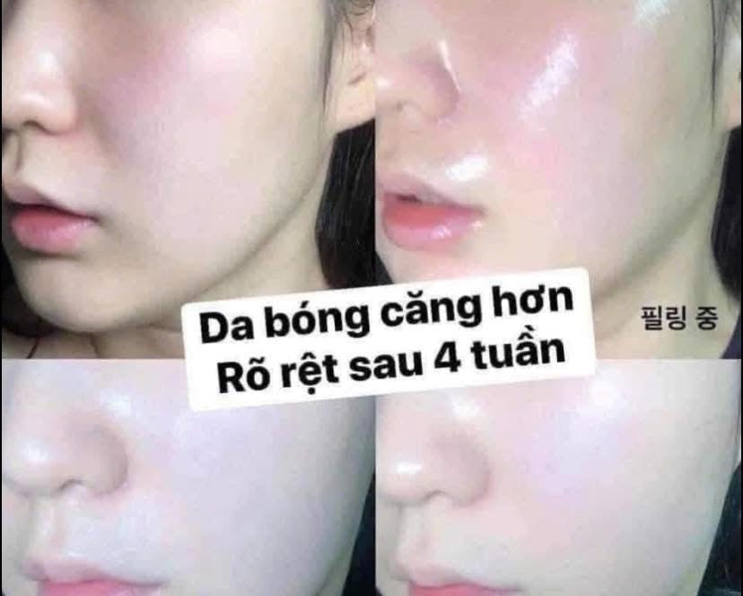Tẩy da chết CNP Laboratory Invisible Peeling Booster 100ml