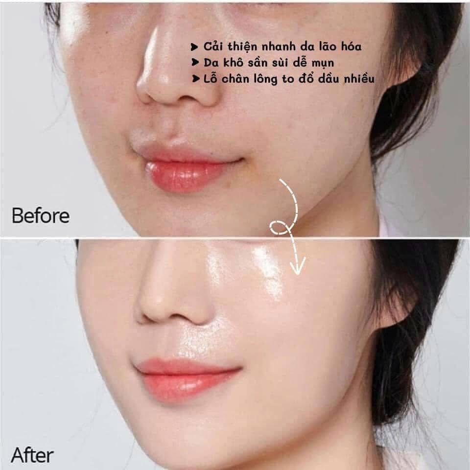 Kem dưỡng OHUI Age Recovery Cream 25ml