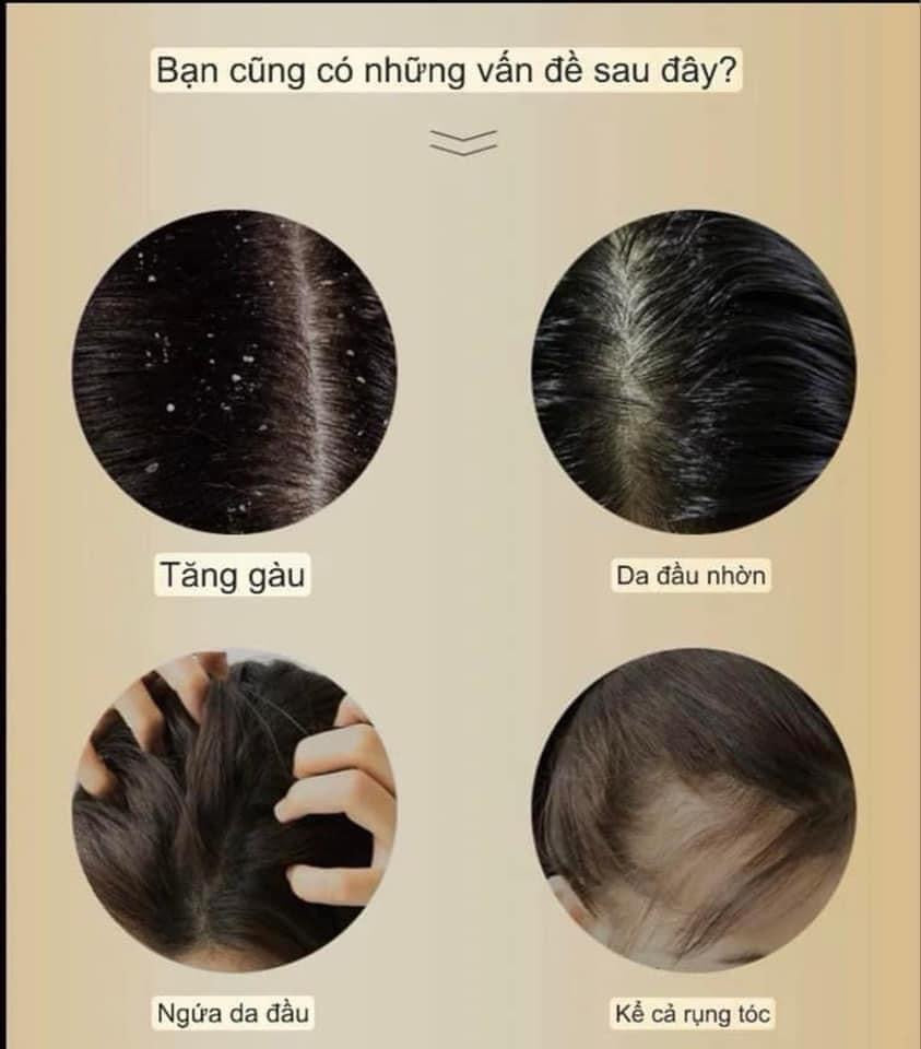 Lược "ma thuật" THE BRASHU DR SCALP