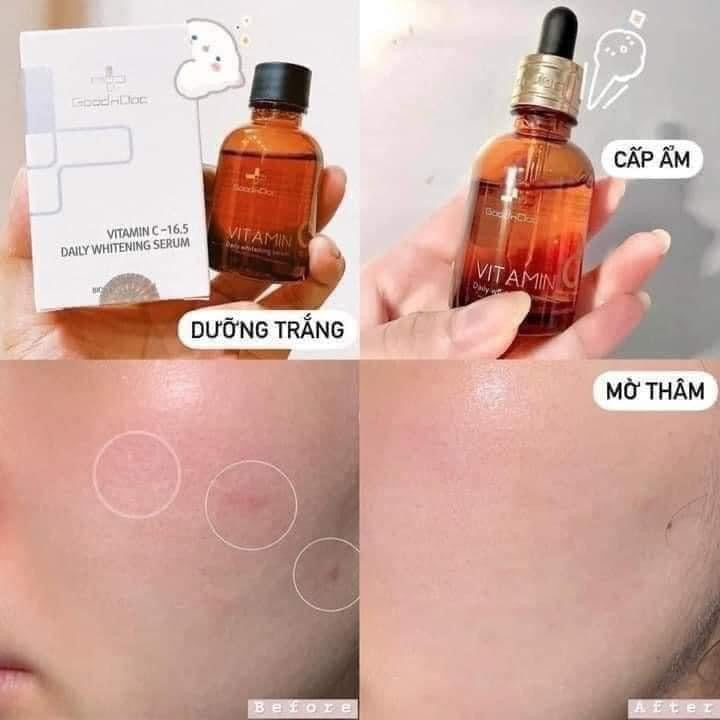 Tinh chất sáng da, mờ thâm nám GOODNDOC Vitamin C-16.5 Daily Whitening Serum 30ml