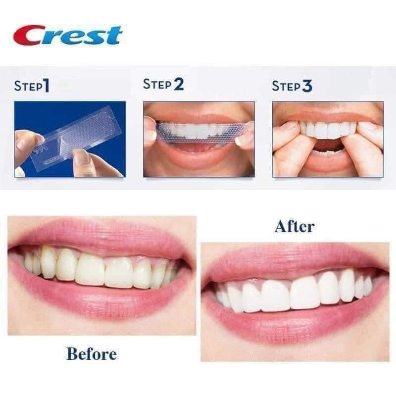 Miếng dán trắng răng cấp tốc CREST 3D WHITESTRIPS 1 Hour Express